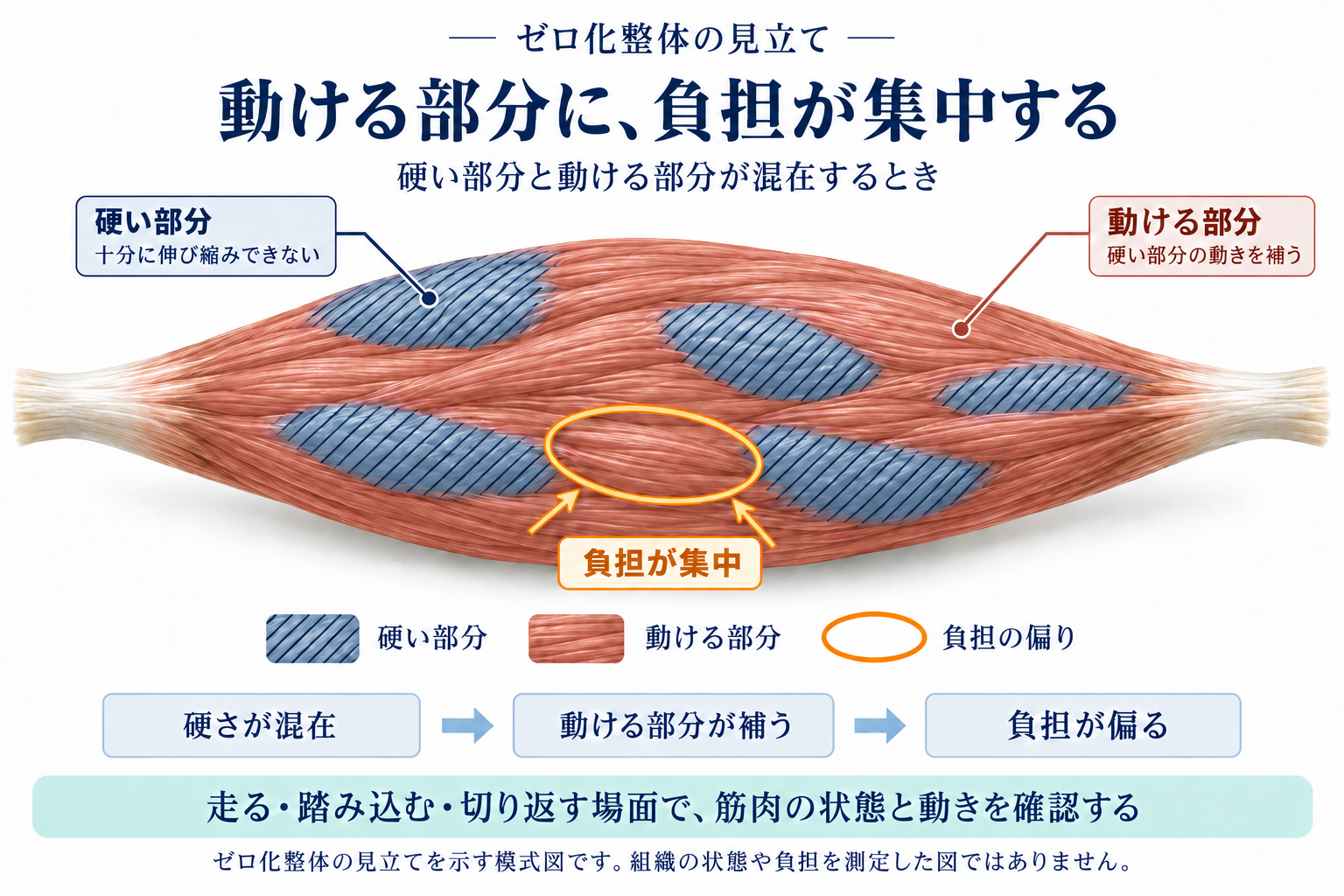 硬い部分が点在する筋肉の中で、動ける部分に負担が集中するというゼロ化整体の見立て